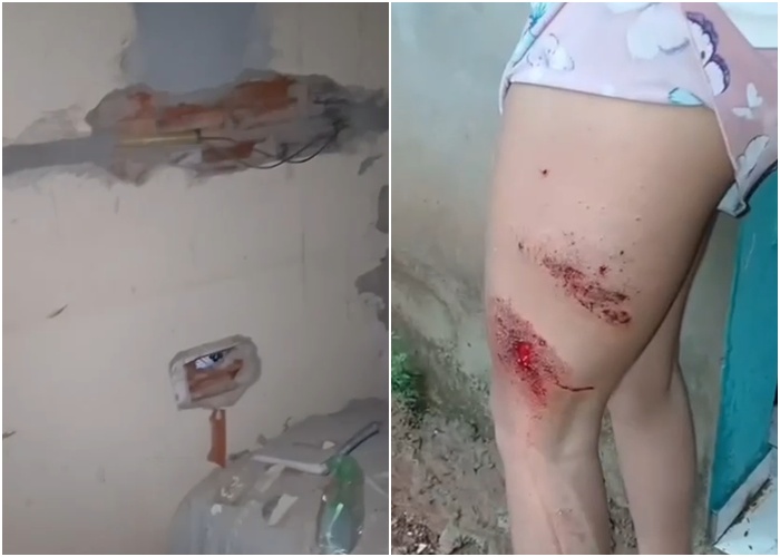 Mulher é atingida por raio durante chuva em Buriti dos Lopes no Piauí