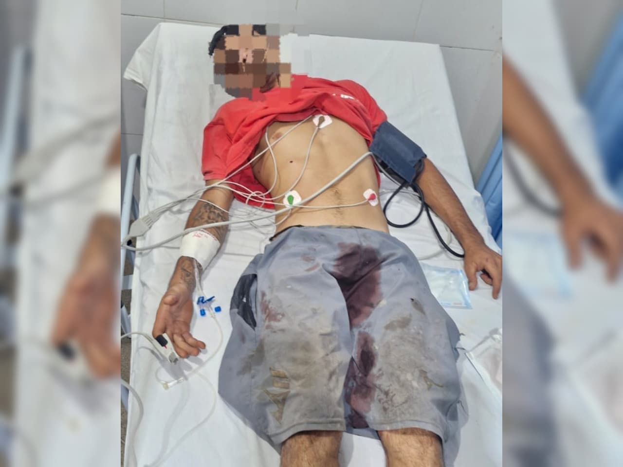 Homem é baleado ao sair de casa durante a noite na zona rural de Batalha